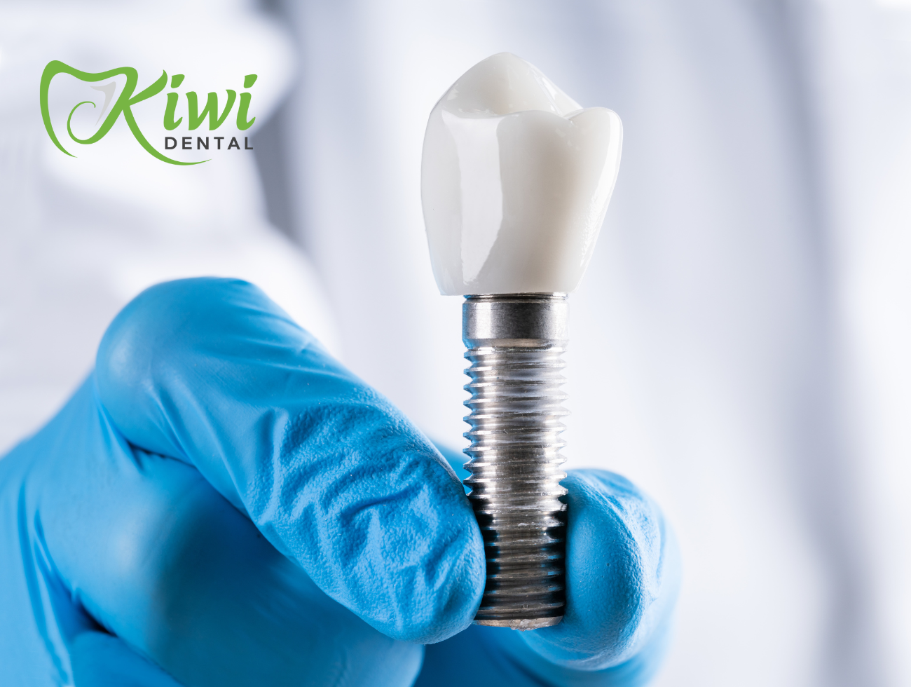 Dental Implants. Implants
