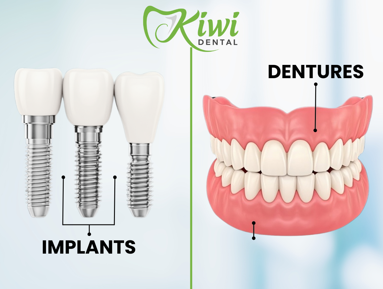 Dental Implants and Dentures