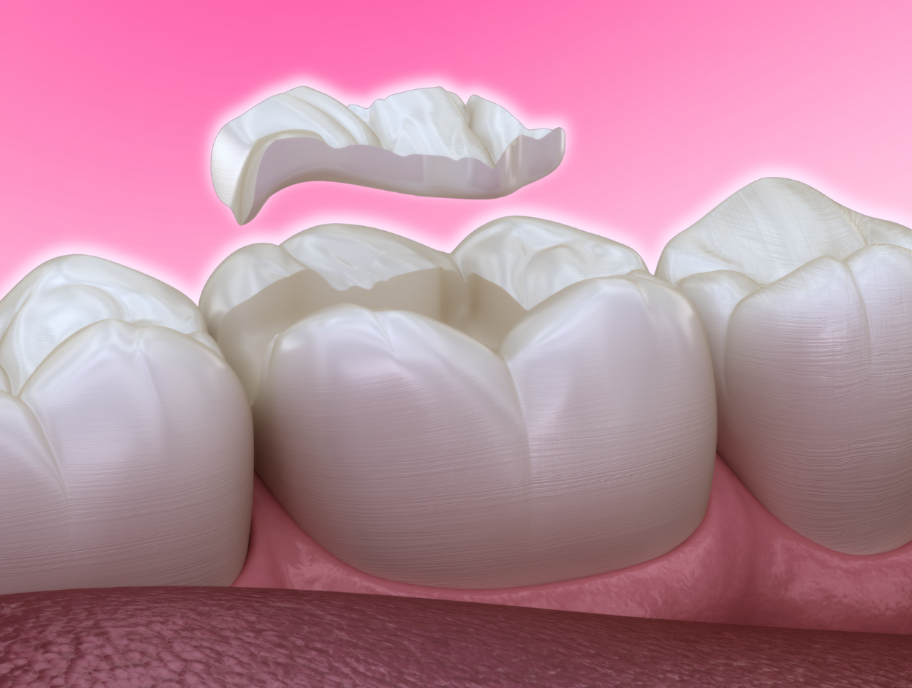 dental services - restorative