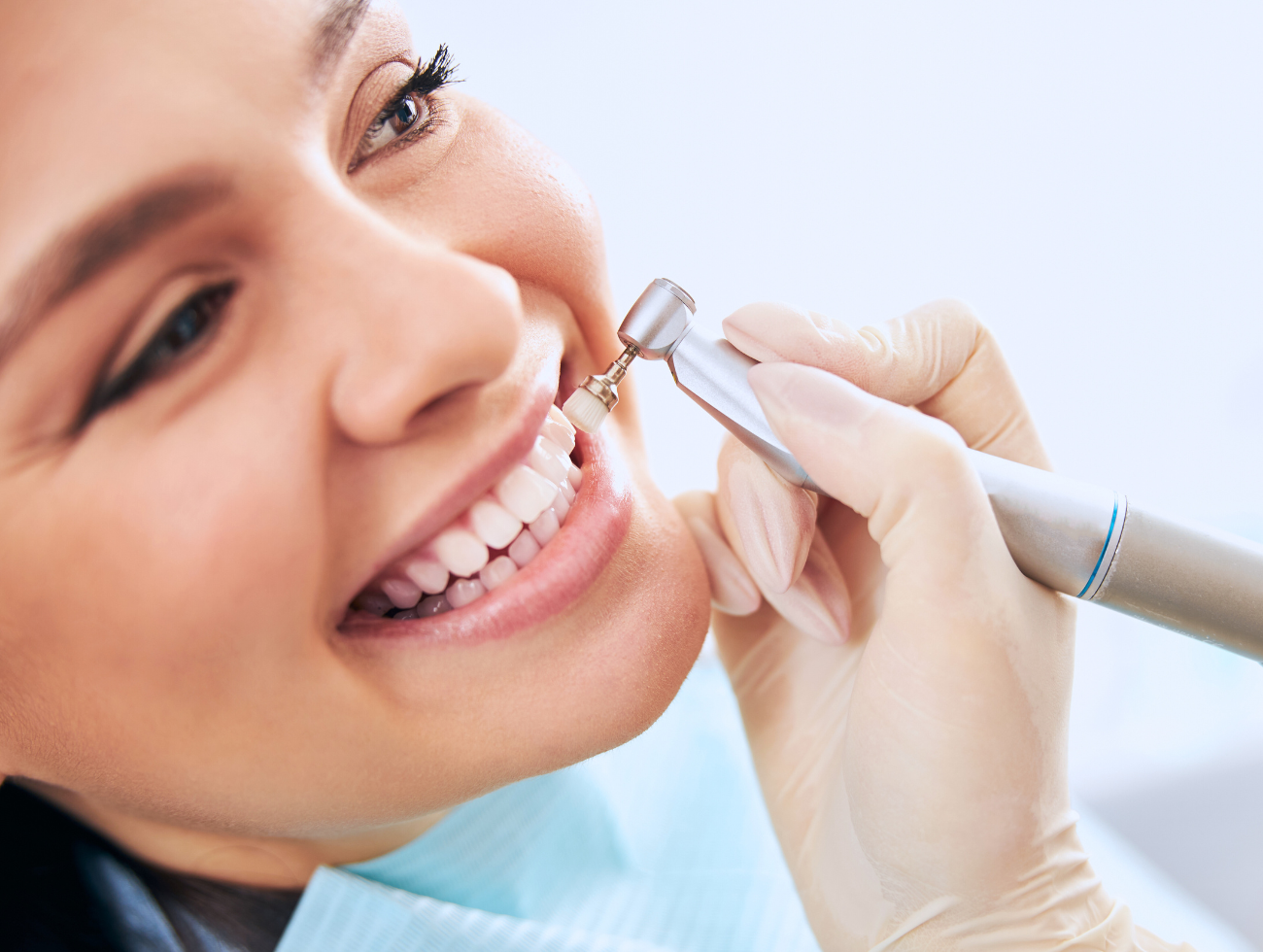 dental services - teeth cleaning