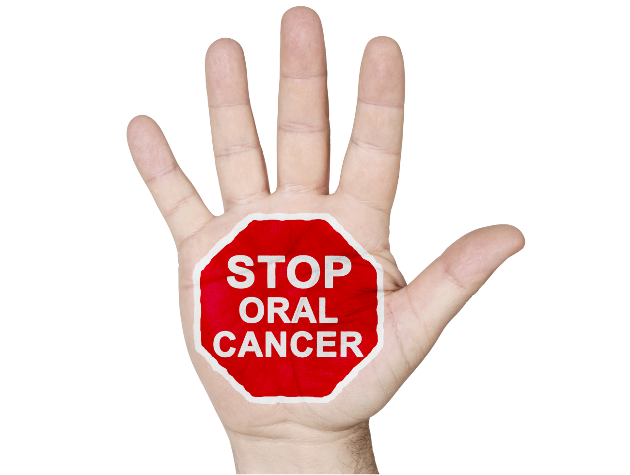 Oral cancer hand sign